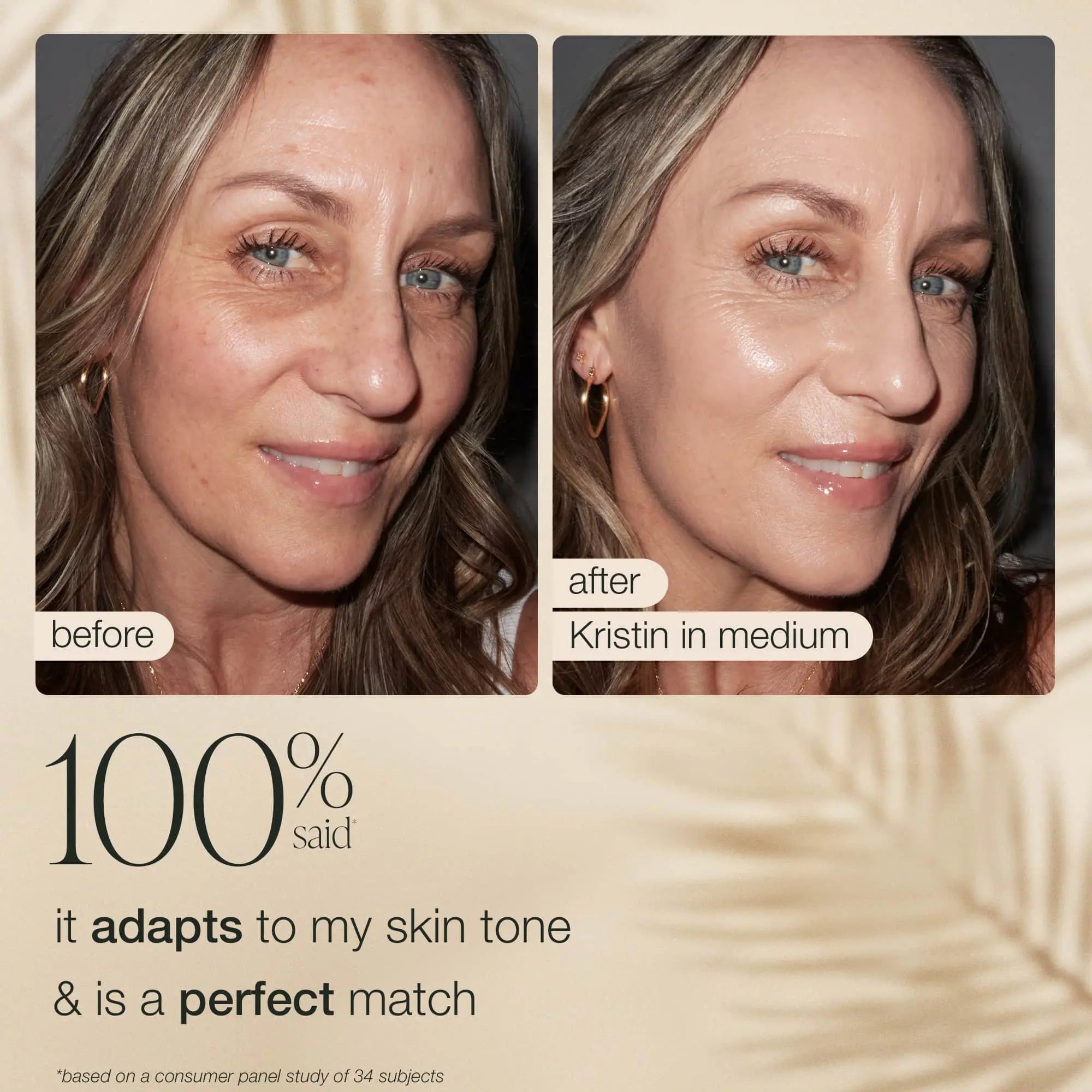 Summer Skin Essentials Bundle