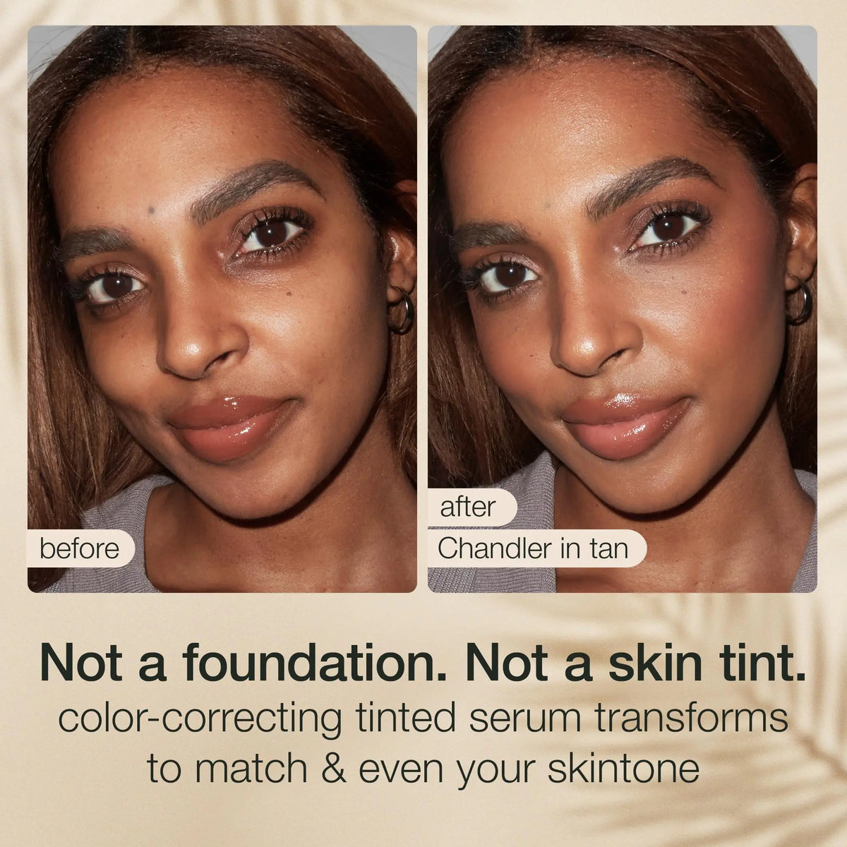 Summer Skin Essentials Bundle